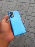 Redmi not 11 abmen