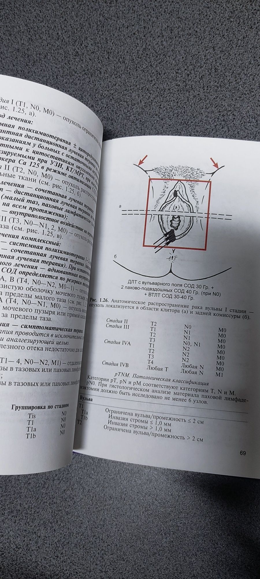 Переломы шейки бедра. Лечение терапия рака.  Медицинские книги