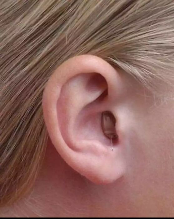 Внутри канальный слуховой аппарат