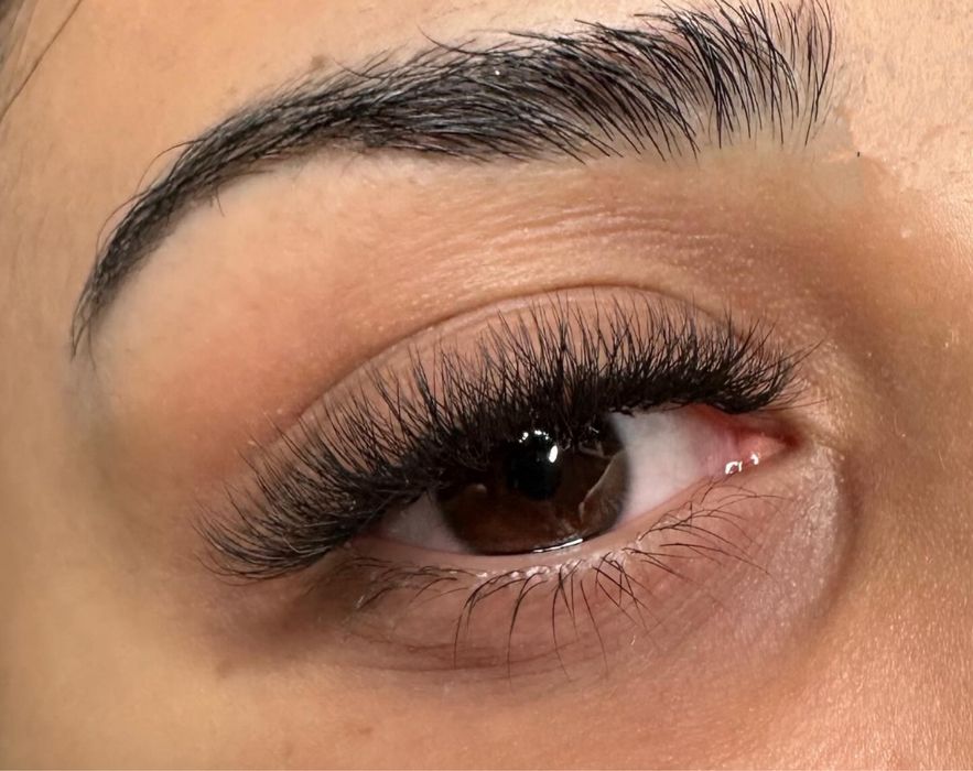 Aplic extensii gene 2/3/4D (colentina)