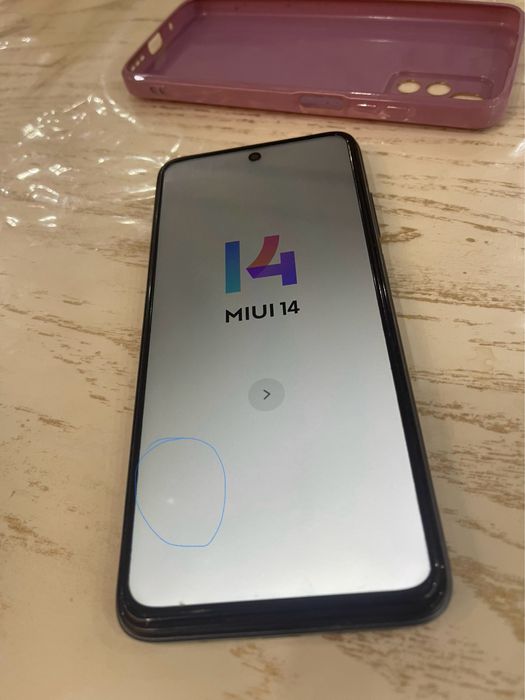 redmi note 11 holati yaxshi