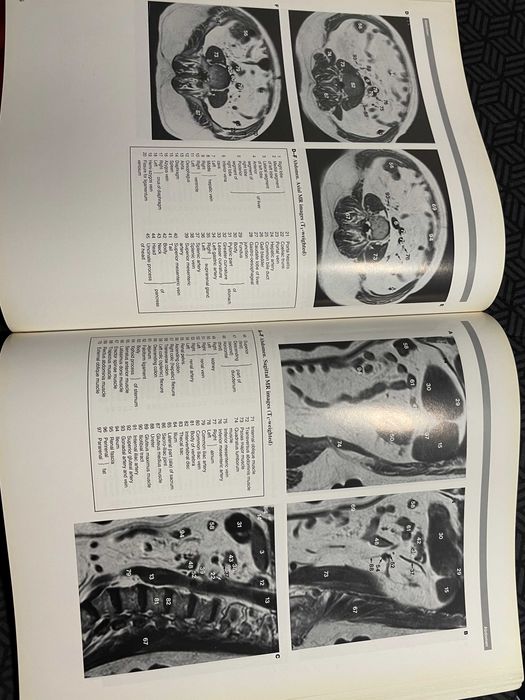 Atlas imagistic de anatomie umana Wolfe medicina rezidentiat impecabil