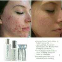 Sistem împotriva acneei NU SKIN® CLEAR ACTION®