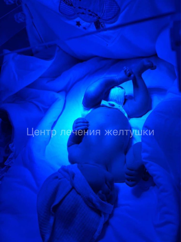 Фотолампа для новорожденных