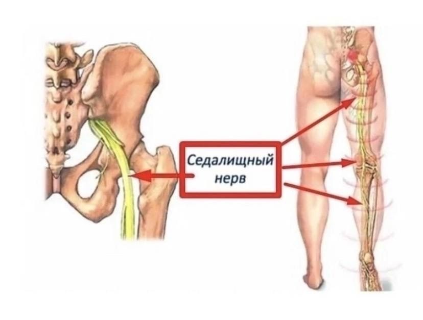 Массаж седальичный нервка. Инсультниктерге. Емдик массаж.