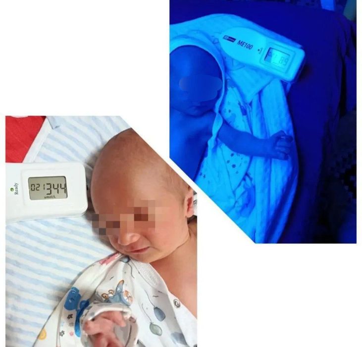 Bolada sariqlikni pasaytirivchi fototerapiya lampasi ijarasi.