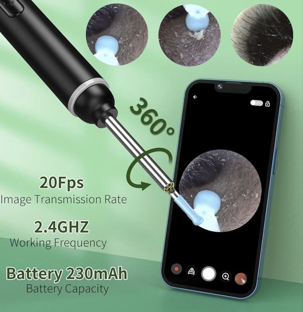 WIFI Отоскоп VITCOCO за премахване на ушна кал 5MP камера/6 LED