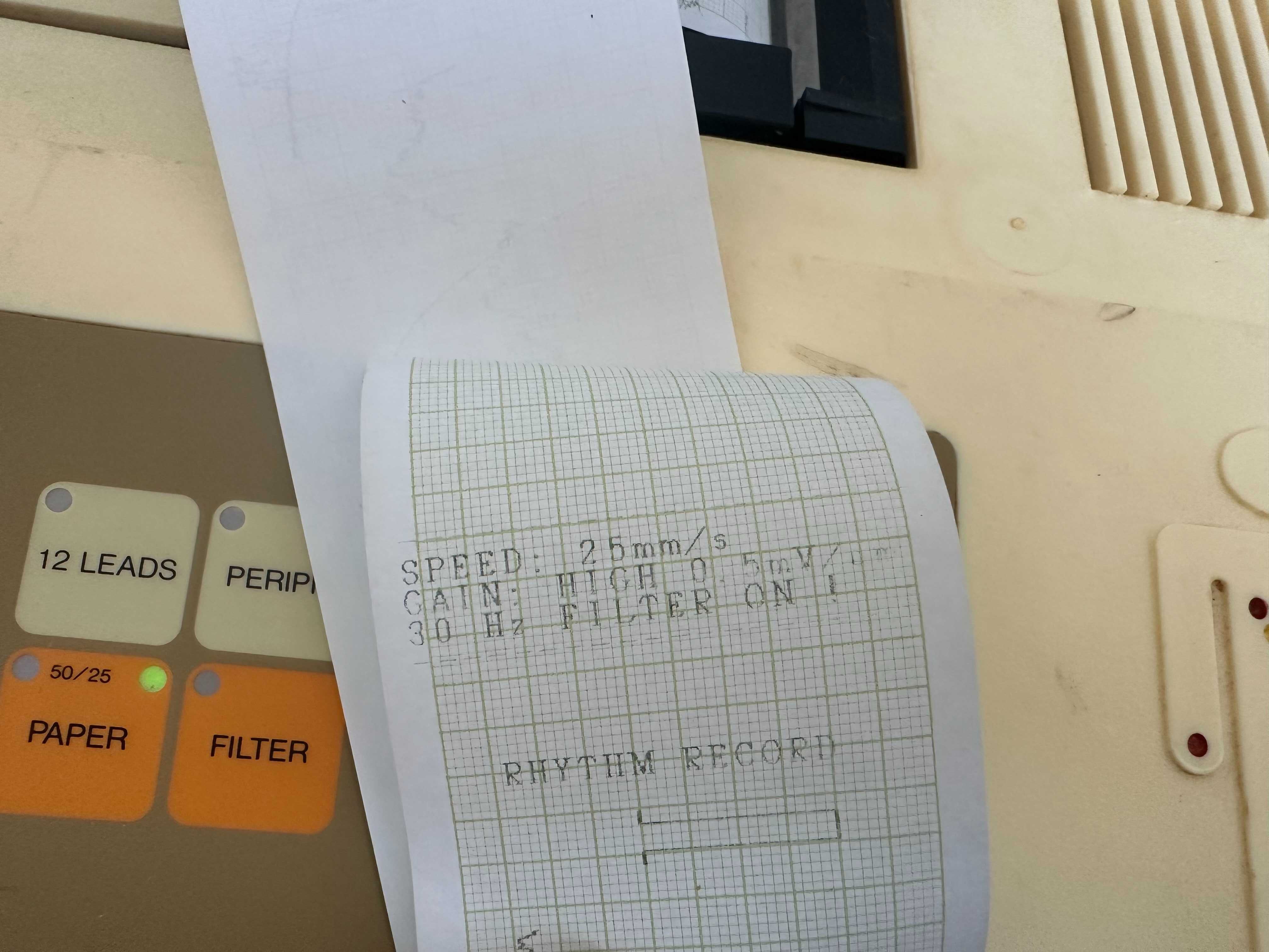 ЕКГ Електрокардиограф ECG 1222 ASB