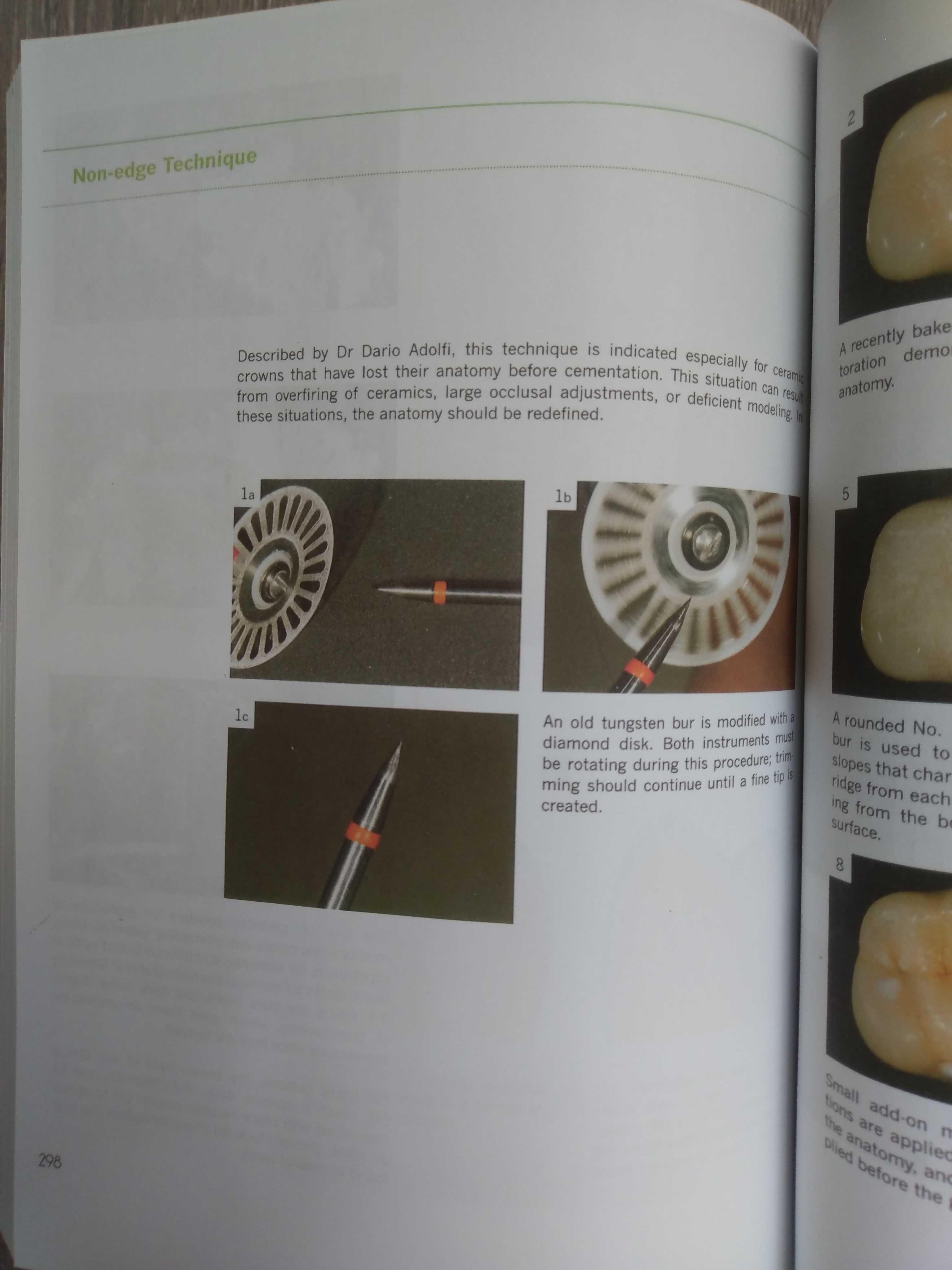 Layers: An Atlas of Composite Resin Stratification - 2012