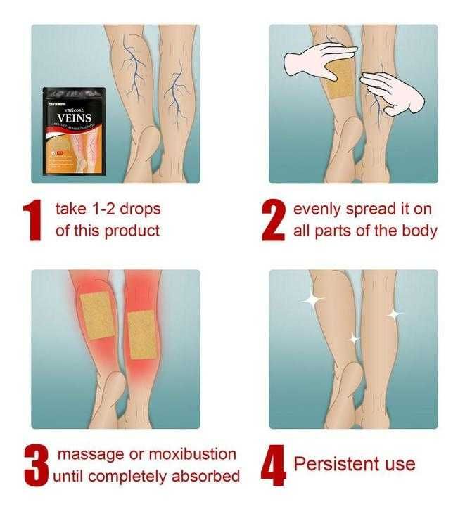 Лепенки При Флебит Атеросклероза Варикоза Пластири за Разширени Вени