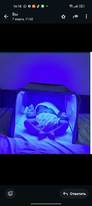 Фототерапия для новорожденных