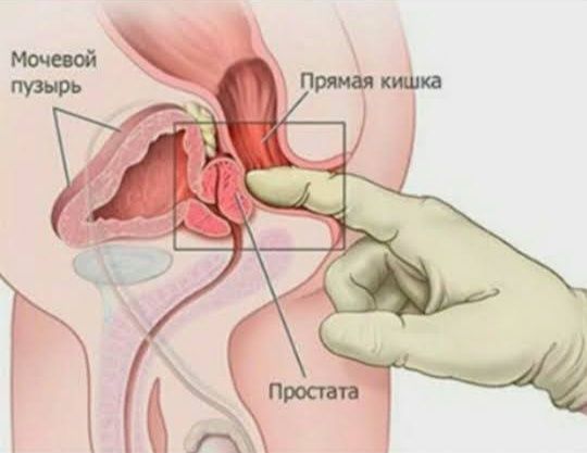 Массаж мужчинам, массаж простаты в Алматы