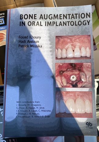 Bone Augmentation in Oral Implantology