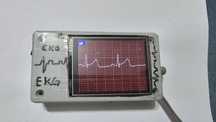 EKG ECG  cu 3 derivati