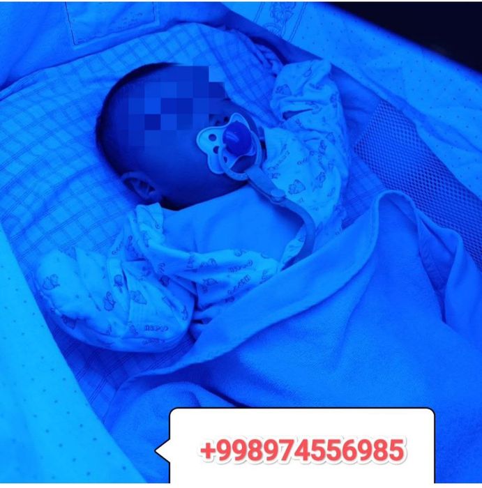 Bolada sariqlikni pasaytirivchi fototerapiya lampasi ijarasi.