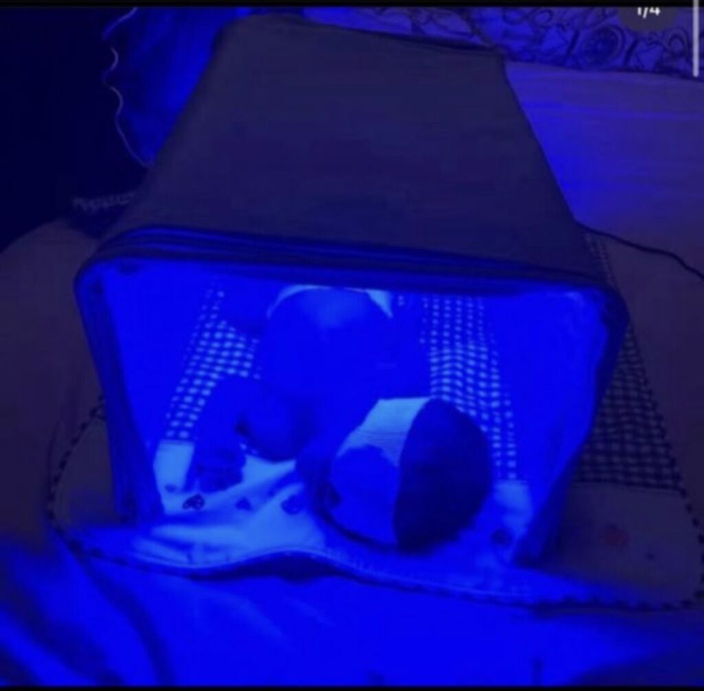 Аренда фотолампы от желтушки для новорожденных, фитотерапия

Количеств