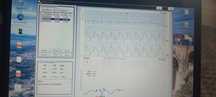 Holter EKG 24h inclusiv Laptop , soft licențiat interpretare