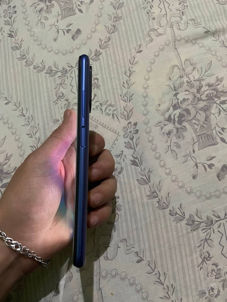Redmi note 10 xolati aloo