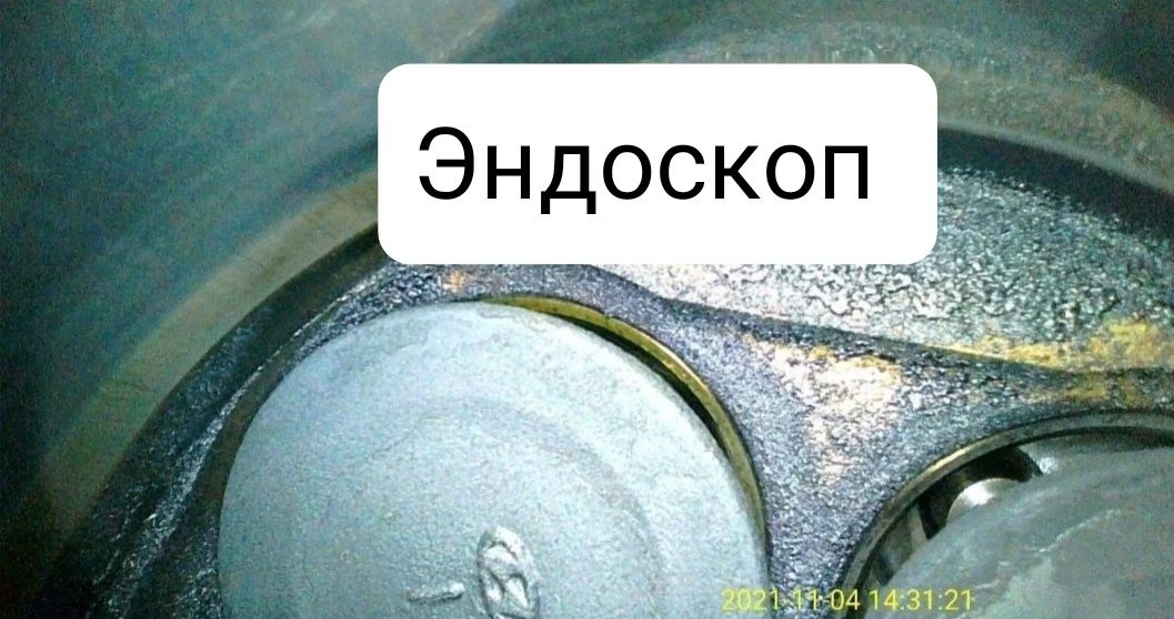 Эндоскопия. эндоскоппен тексеру.