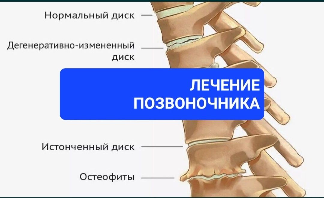 Мануальная терапия, костоправ, лечение позвоночника