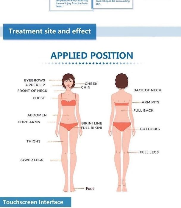 De Vanzare. 808NM Diode Laser