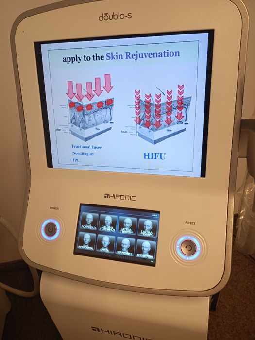 HIFU апарат от Южна Корея - DOUBLO-S от HIRONIC