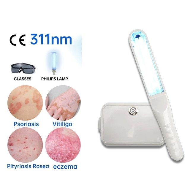 Облучатель ультрафиолетовый для лечения псориаза витилиго