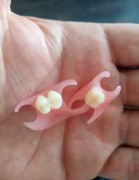 Зубные съёмные протезы