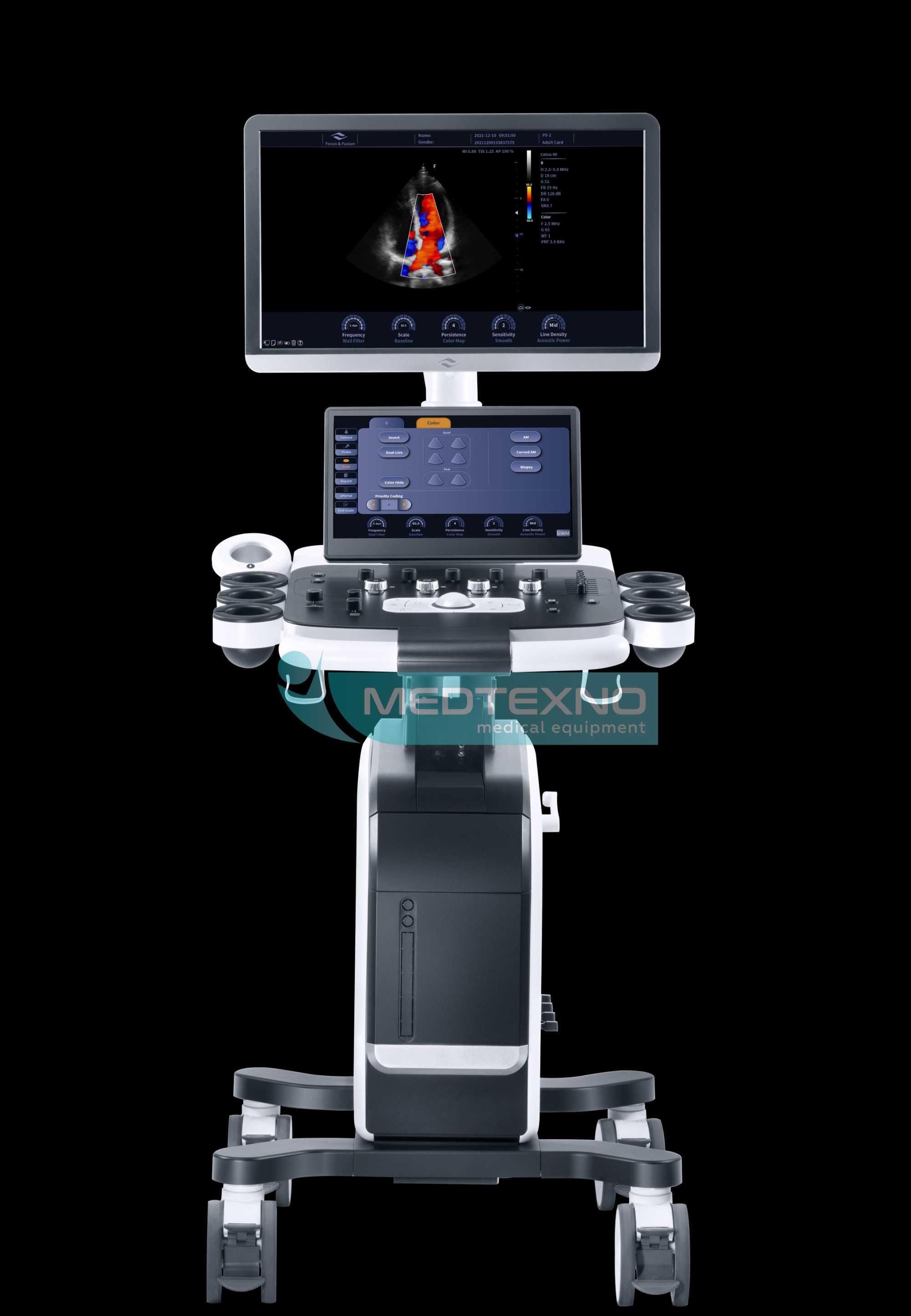 Cetus 40 – УЗИ аппарат с доплер системой с 3D/4D и объёмным датчиком