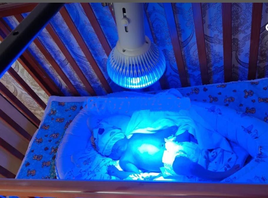 Аренда ламп от желтухи, БИЛИТЕСТ - замер уровня билирубина в крови.