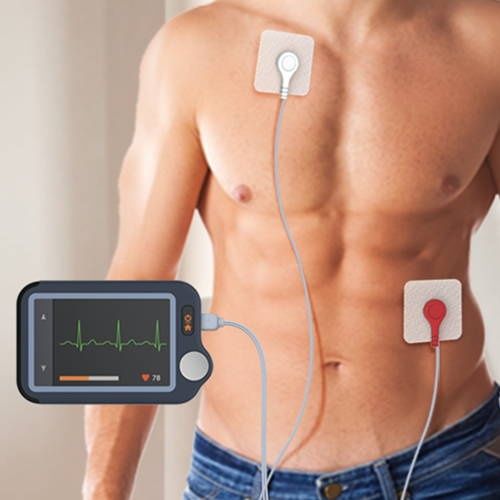 Aparat monitorizare EKG "Checkme Plus" Nou, Full Box