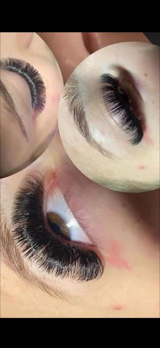 Aplic extensii de gene  1-4D /soft volum / mega volum