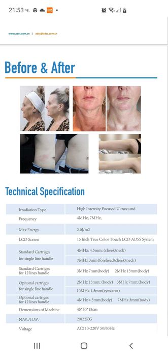 Hifu апарат за стягане кожата на лице и тяло с опция топене на мазнини