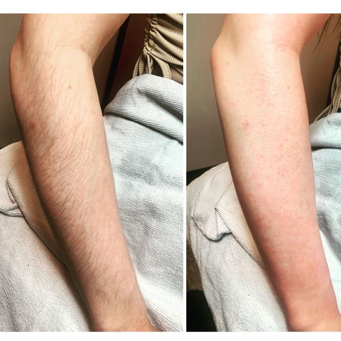 Шугаринг мужской и женский