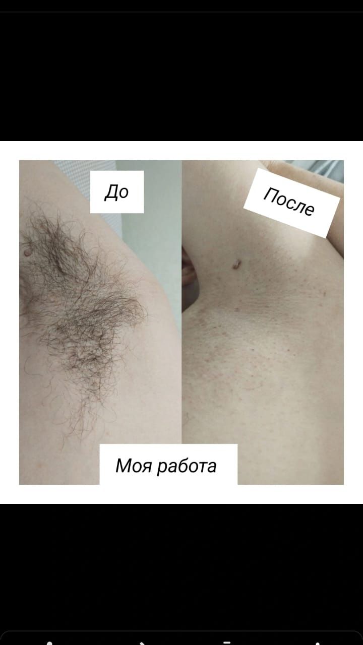 Шугаринг пилинг ног