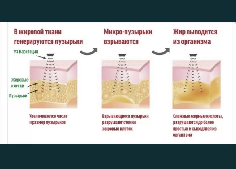 Косметологический аппарат