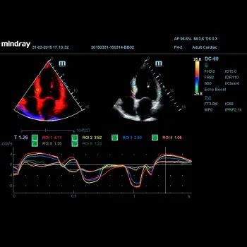 УЗИ Апарат Mindray DC-60 X-insight