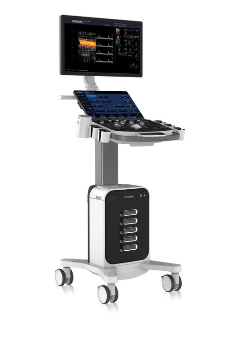 УЗИ аппарат Chison Sonomax