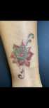 Îndepărtare stergere tatuaje