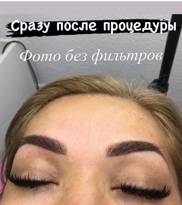 Перманентный макияж, удаление татуажа и тату