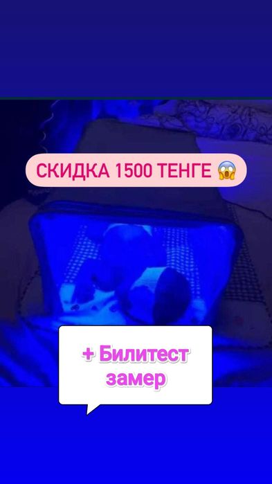 Аренда фотолампы от желтухи для детей (желтушки) Билирубин замер