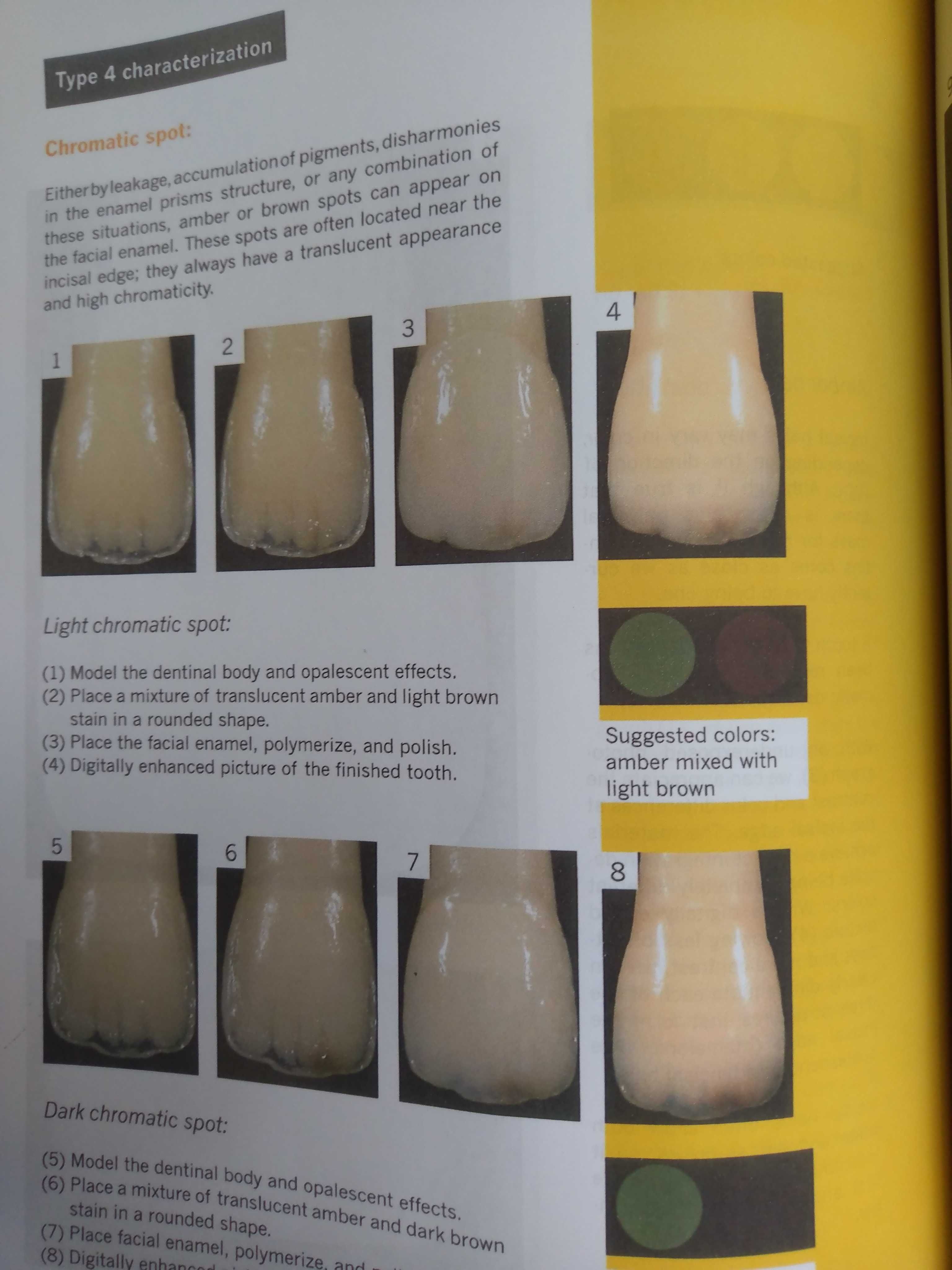 Layers: An Atlas of Composite Resin Stratification - 2012