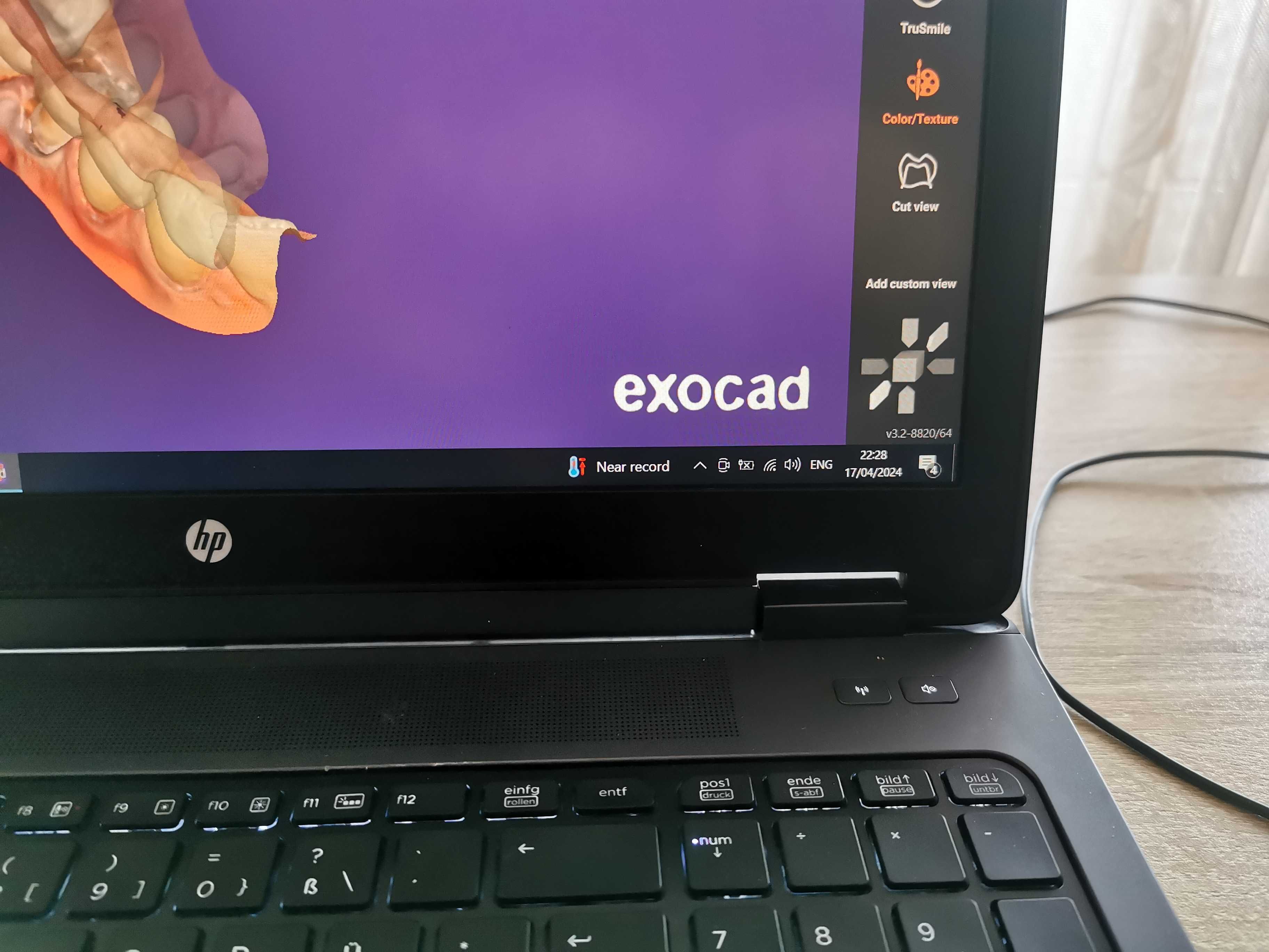 Hp zbook с инсталиран exocad, exoplan, partial cad, maestro и romexis