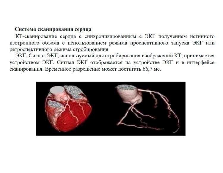 Компьютерный томограф NeuViz 64