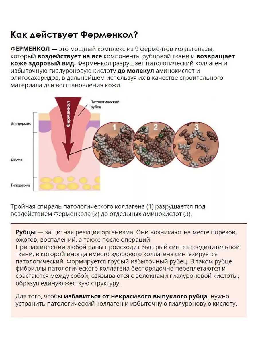 Ферменкол гель от рубцов и шрамов. Объем 30г.
