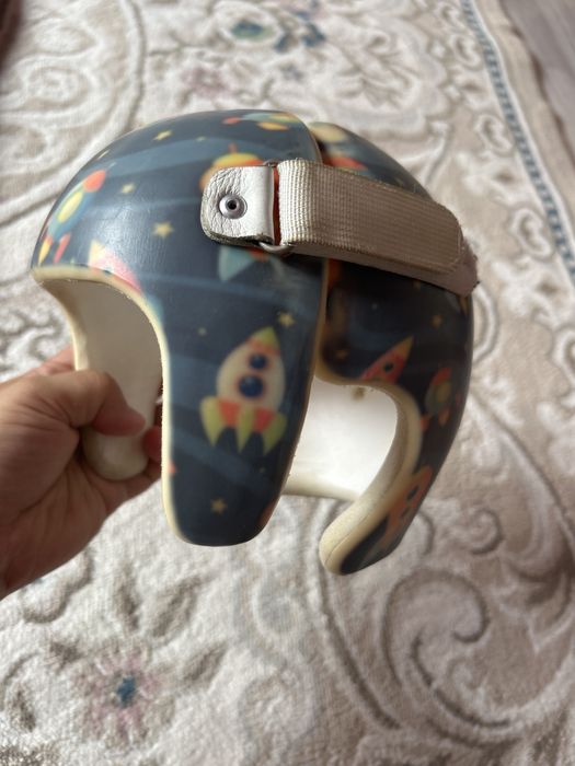 ортапедический шлем для лечения