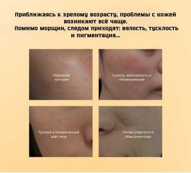 Тонер для лица, увлажняющая, успокаивает мышцы и смягчает кожу, 100 мл