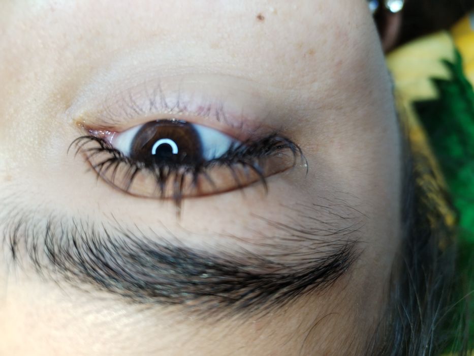 Narashevanniy kiprik