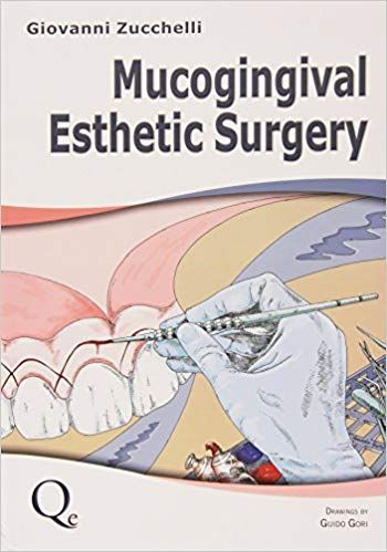 Mucogingival Esthetic Surgery - Giovanni Zucchelli