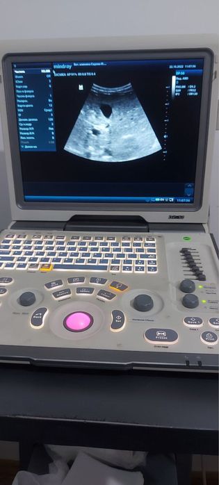 УЗИ аппарат Миндрай Dp-50